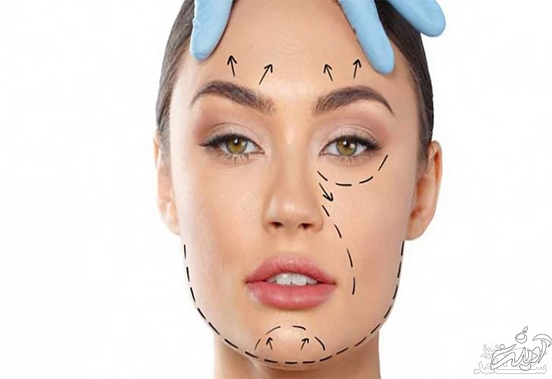  فیس لیفت صورت